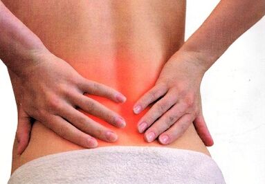 Low back pain in a woman