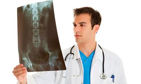 the doctor sees an x-ray to diagnose back pain